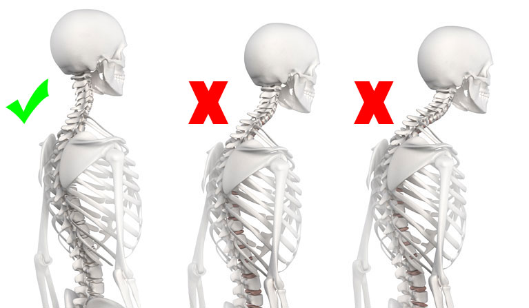 Fitness will help you prevent adopting a  bad posture.