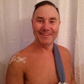 Shoulder Surgery in Your 60’s: Bill’s Story