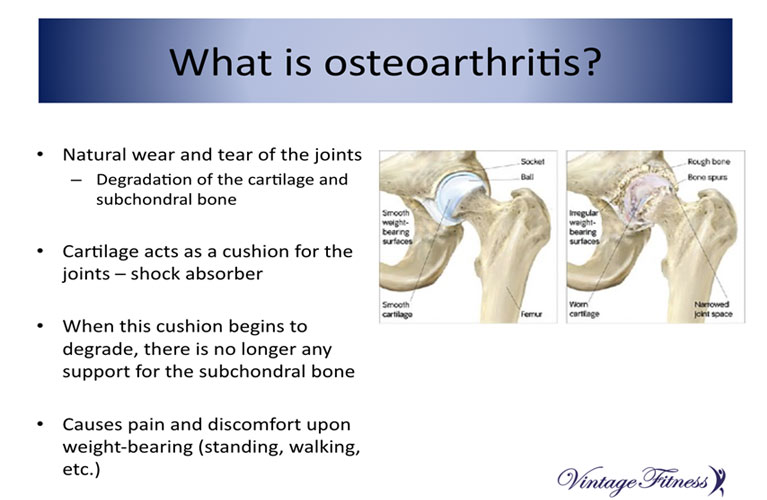 What is osteroarthritis